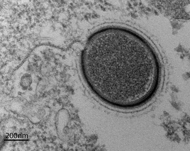 Le Mollivirus sibericum est un virus géant préhistorique qui dormait depuis 30 000 ans !