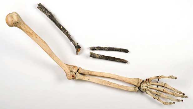 Les 3 os longs du bras gauche d'un pré-Néandertalien (en haut) en regard d'un bras moderne retrouvé sur le site deTourvilIe-Ia-Rivière (Seine-Maritime) en 2010.