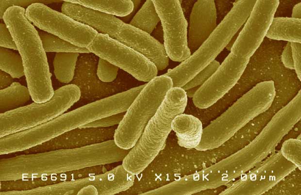 image-descherichia-coli-prise-avec-un-microscope-electronique-a-balayage