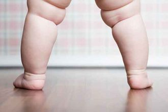 L'obésité des enfants est la cause de l'apparition précoce du diabète de type